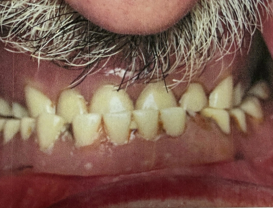 Before smile makeover